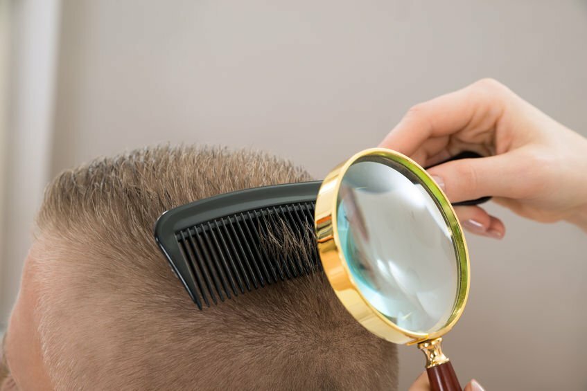 Capire come prevenire la caduta capelli uomo
